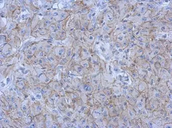 Anti-N-Cadherin antibody [N2C1], Internal used in IHC (Paraffin sections) (IHC-P). GTX112733