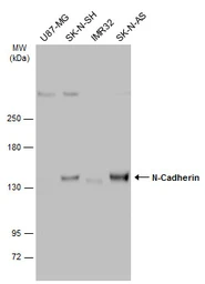 Anti-N-Cadherin antibody [N1N3] used in Western Blot (WB). GTX112734