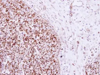 Anti-mtTFA antibody used in IHC (Paraffin sections) (IHC-P). GTX112760