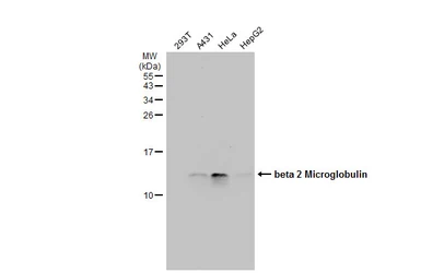 Anti-beta 2 Microglobulin antibody used in Western Blot (WB). GTX112815