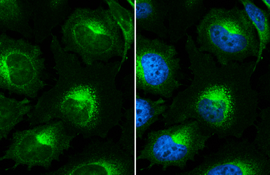 Anti-beta 2 Microglobulin antibody used in Immunocytochemistry/ Immunofluorescence (ICC/IF). GTX112815