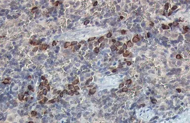 Anti-beta 2 Microglobulin antibody used in IHC (Paraffin sections) (IHC-P). GTX112815