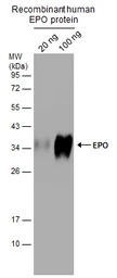 Anti-EPO antibody used in Western Blot (WB). GTX112834