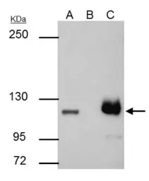 Anti-PARP antibody [N2C1], Internal used in Immunoprecipitation (IP). GTX112864