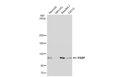 Anti-PARP antibody [N2C1], Internal used in Western Blot (WB). GTX112864