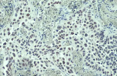 Anti-PARP antibody [N2C1], Internal used in IHC (Paraffin sections) (IHC-P). GTX112864