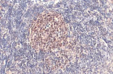 Anti-PARP antibody [N2C1], Internal used in IHC (Paraffin sections) (IHC-P). GTX112864