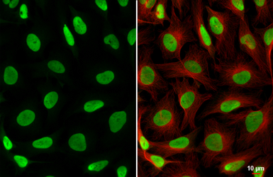 Anti-PARP antibody [N2C1], Internal used in Immunocytochemistry/ Immunofluorescence (ICC/IF). GTX112864