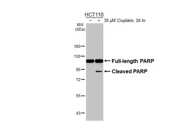 Anti-PARP antibody [N2C1], Internal used in Western Blot (WB). GTX112864