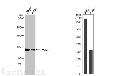 Anti-PARP antibody [N2C1], Internal used in Western Blot (WB). GTX112864