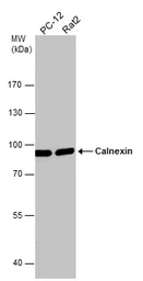 Anti-Calnexin antibody used in Western Blot (WB). GTX112886