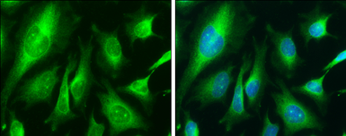 Anti-Calnexin antibody used in Immunocytochemistry/ Immunofluorescence (ICC/IF). GTX112886