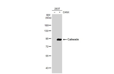 Anti-Calnexin antibody used in Western Blot (WB). GTX112886