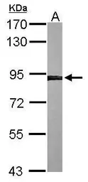 Anti-Calnexin antibody used in Western Blot (WB). GTX112886