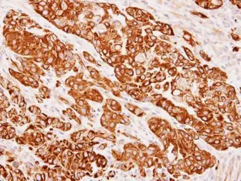 Anti-Cytokeratin 8 antibody [N1C1] used in IHC (Paraffin sections) (IHC-P). GTX112975