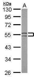 Anti-Cytokeratin 8 antibody [N1C1] used in Western Blot (WB). GTX112975