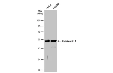 Anti-Cytokeratin 8 antibody [N1C1] used in Western Blot (WB). GTX112975