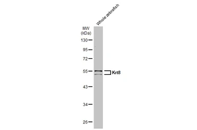 Anti-Cytokeratin 8 antibody [N1C1] used in Western Blot (WB). GTX112975