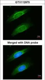 Anti-Cytokeratin 8 antibody [N1C1] used in Immunocytochemistry/ Immunofluorescence (ICC/IF). GTX112975