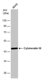 Anti-Cytokeratin 18 antibody [N1N3] used in Western Blot (WB). GTX112977