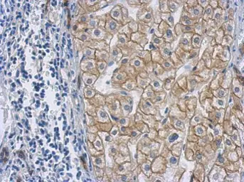 Anti-Cytokeratin 18 antibody [N1N3] used in IHC (Paraffin sections) (IHC-P). GTX112977