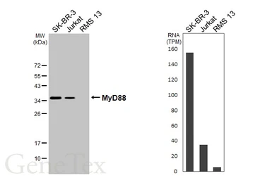 Anti-MyD88 antibody used in Western Blot (WB). GTX112987