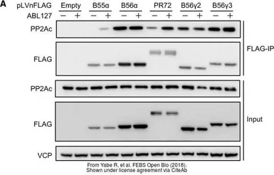 Anti-VCP antibody [N1N2], N-term used in Western Blot (WB). GTX113030