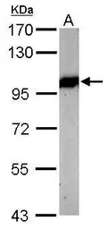 Anti-VCP antibody [N1N2], N-term used in Western Blot (WB). GTX113030