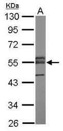 Anti-ERG antibody [N3C3] used in Western Blot (WB). GTX113079