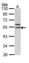 Anti-ERG antibody [N3C3] used in Western Blot (WB). GTX113079