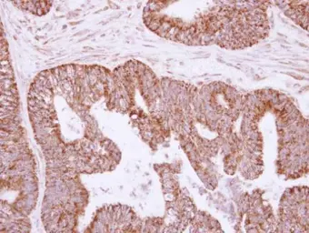 Anti-IL1 alpha antibody used in IHC (Paraffin sections) (IHC-P). GTX113088