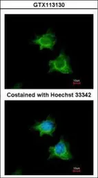 Anti-XIAP antibody [N1C1] used in Immunocytochemistry/ Immunofluorescence (ICC/IF). GTX113130