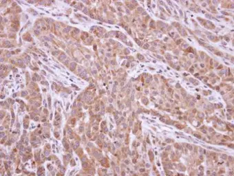 Anti-XIAP antibody [N1C1] used in IHC (Paraffin sections) (IHC-P). GTX113130