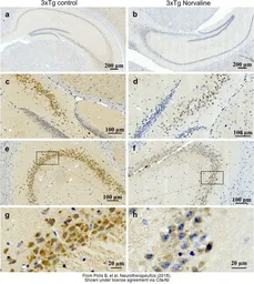 Anti-Arginase 1 antibody used in IHC (Paraffin sections) (IHC-P). GTX113131