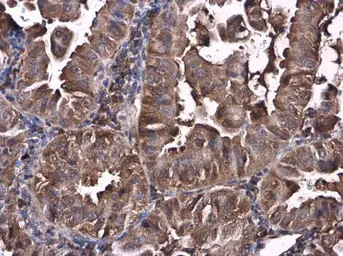 Anti-Caspase 10 antibody used in IHC (Paraffin sections) (IHC-P). GTX113148