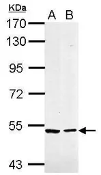 Anti-Caspase 10 antibody used in Western Blot (WB). GTX113148