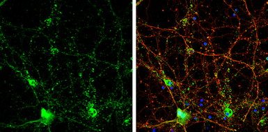 Anti-Choline Acetyltransferase antibody [N1N3] used in Immunocytochemistry/ Immunofluorescence (ICC/IF). GTX113164