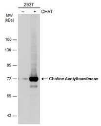 Anti-Choline Acetyltransferase antibody [N1N3] used in Western Blot (WB). GTX113164