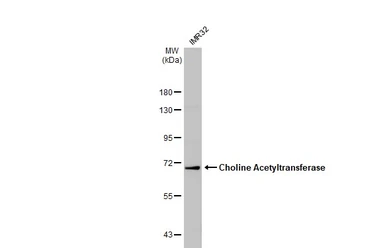 Anti-Choline Acetyltransferase antibody [N1N3] used in Western Blot (WB). GTX113164