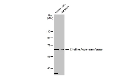 Anti-Choline Acetyltransferase antibody [N1N3] used in Western Blot (WB). GTX113164