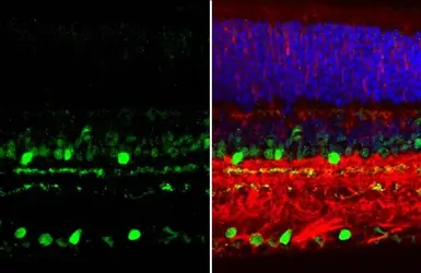 Anti-Choline Acetyltransferase antibody [N1N3] used in IHC (Paraffin sections) (IHC-P). GTX113164