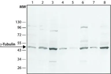 Anti-gamma Tubulin antibody used in Western Blot (WB). GTX11317