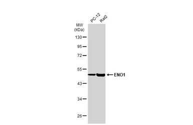 Anti-ENO1 antibody used in Western Blot (WB). GTX113179