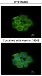 Anti-ENO1 antibody used in Immunocytochemistry/ Immunofluorescence (ICC/IF). GTX113179