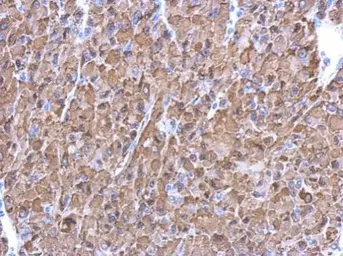 Anti-ENO1 antibody used in IHC (Paraffin sections) (IHC-P). GTX113179