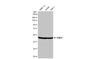 Anti-ENO1 antibody used in Western Blot (WB). GTX113179