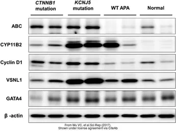 Anti-GATA4 antibody used in Western Blot (WB). GTX113194