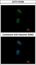 Anti-GATA4 antibody used in Immunocytochemistry/ Immunofluorescence (ICC/IF). GTX113194