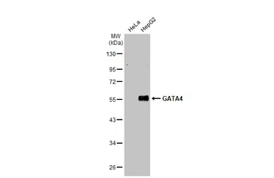 Anti-GATA4 antibody used in Western Blot (WB). GTX113194