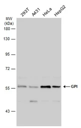 Anti-GPI antibody used in Western Blot (WB). GTX113203